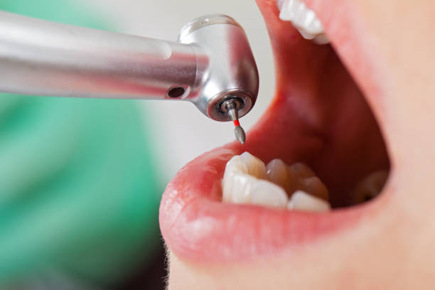 Best Urgent Dental Care for Toothache in Cera, AL